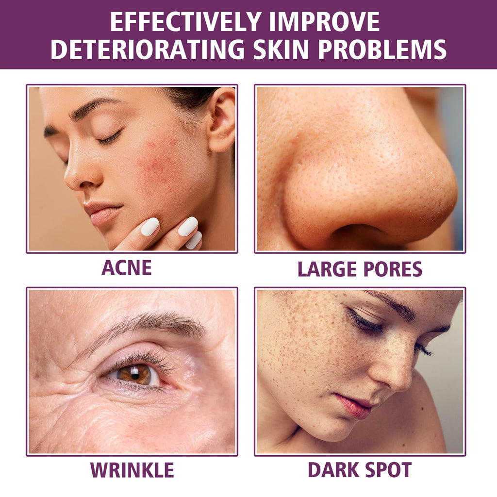 20% Niacinamide B3 Concentrated Anti-Aging For Discoloration And Minimizing Large Pores Fragrance Free And Paraben Free 20ml