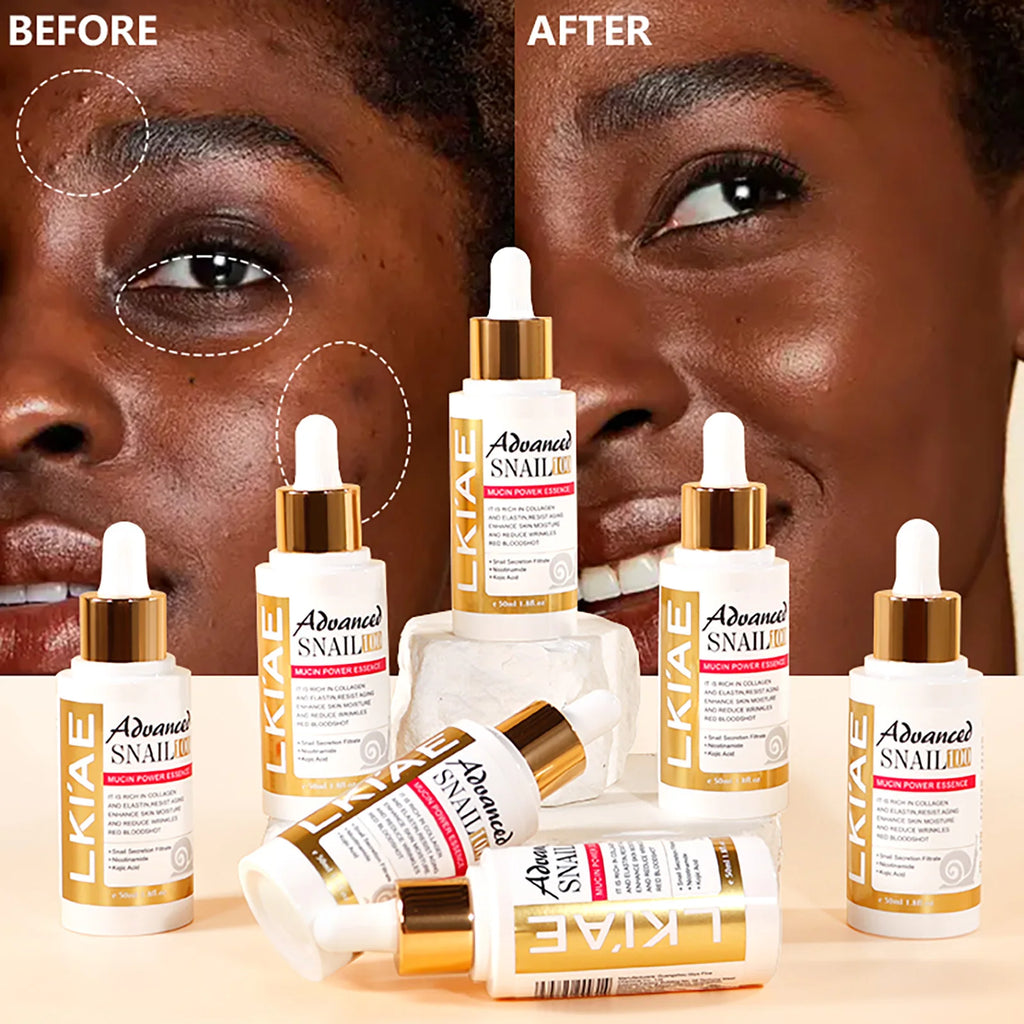 Advanced Snail Mucin Power Essence, Brightening and Firming Skin Serum, Reduce Wrinkles, Dry Lines, Dark Spots, With Collagen