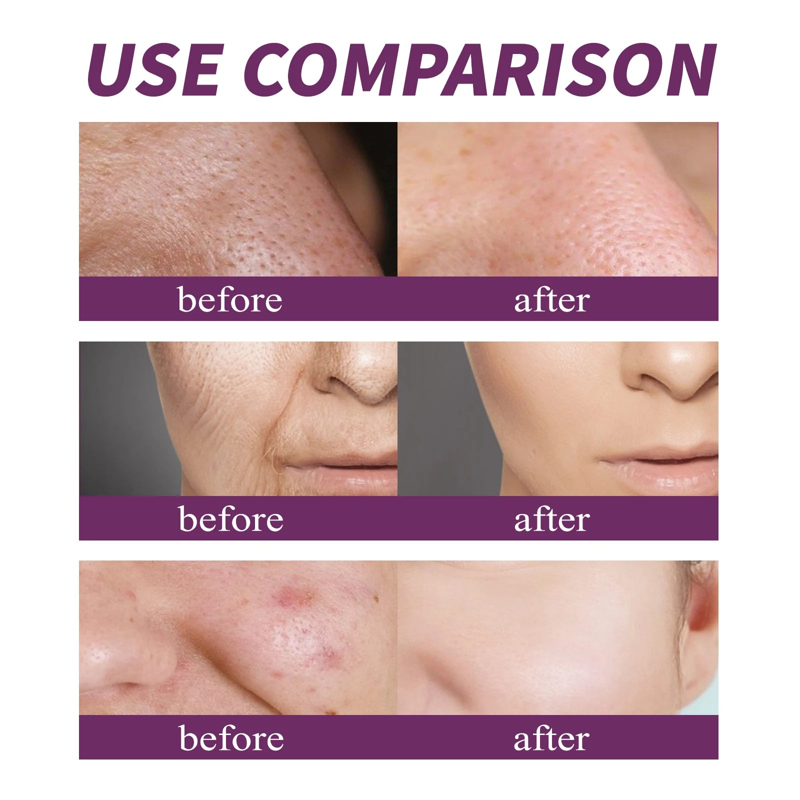20% Niacinamide B3 Concentrated Anti-Aging For Discoloration And Minimizing Large Pores Fragrance Free And Paraben Free 20ml