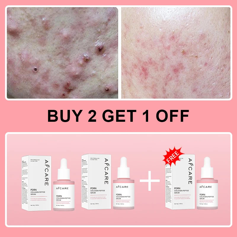 Korean Collagen Peptide Facial Serum – Salmon PDRN