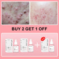 Korean Collagen Peptide Facial Serum – Salmon PDRN
