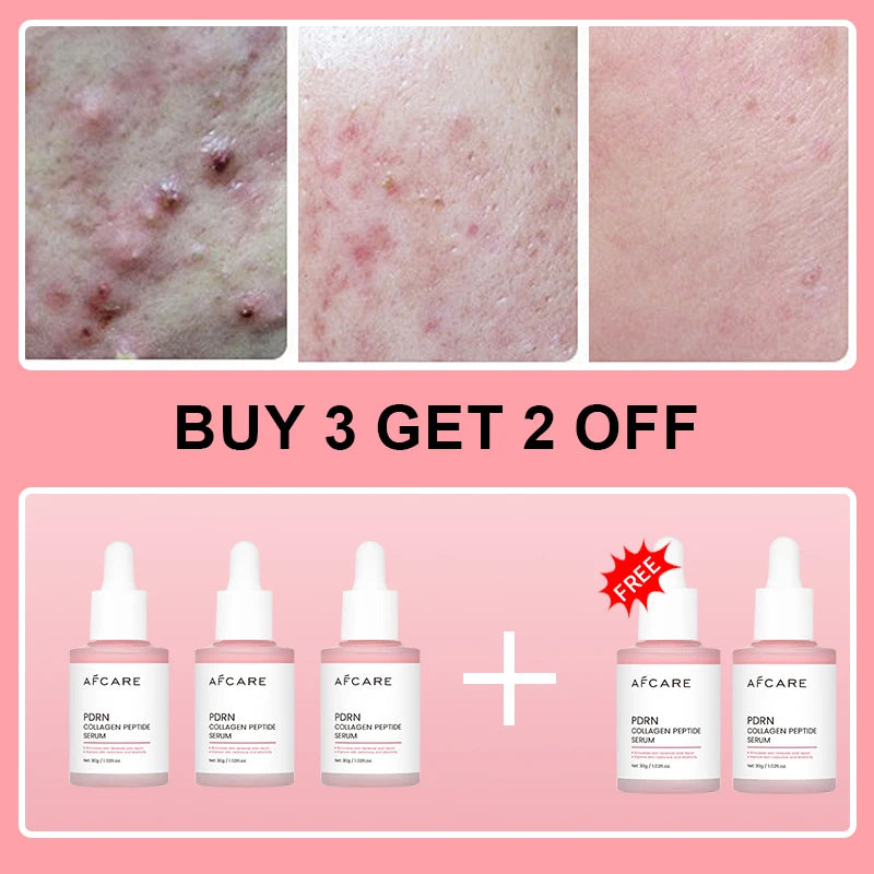 Korean Collagen Peptide Facial Serum — Salmon PDRN