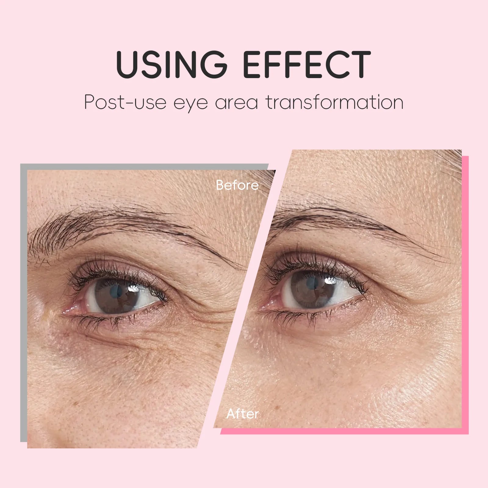 LAIKOU 15ml Sakura Roller Eye Serum Hyaluronic Acid Moisturizing Fade Dark Circles Eye Bags Fine Lines Massage Eye Care