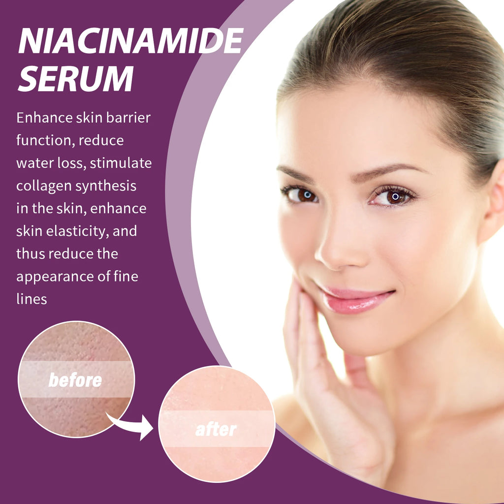 20% Niacinamide B3 Concentrated Anti-Aging For Discoloration And Minimizing Large Pores Fragrance Free And Paraben Free 20ml